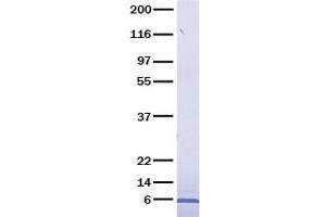 Relaxin 2 Protein (RLN2) (Transcript Variant 2)