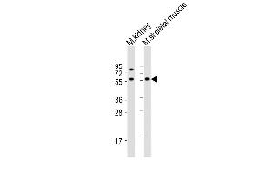 All lanes : Anti-Acvr2b Antibody (Center) at 1:1000 dilution Lane 1: mouse kidney lysate Lane 2: mouse skeletal muscle lysate Lysates/proteins at 20 μg per lane. (ACVR2B antibody  (AA 148-176))