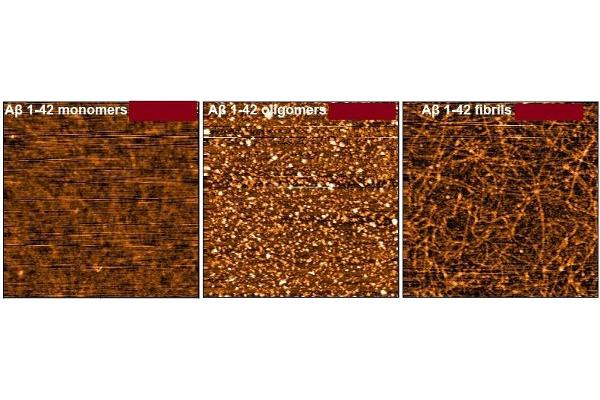 beta Amyloid Protein