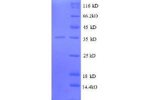 50S Ribosomal Protein L31 (AA 1-70), (full length) protein (GST tag)