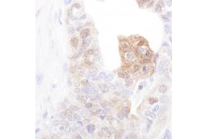 Immunohistochemistry (IHC) image for anti-Calcium/calmodulin-Dependent Protein Kinase IV (CAMK4) (C-Term) antibody (ABIN7453953)