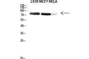 Western Blot (WB) analysis of L929 MCF7 HeLa cells using Antibody diluted at 2000. (DDX3X antibody  (Lys8))