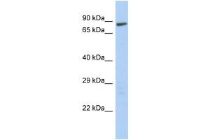 WB Suggested Anti-LAS1L Antibody Titration:  0.