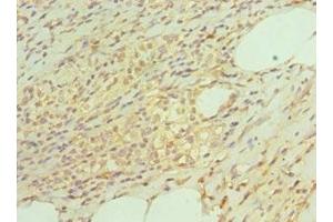 Immunohistochemistry of paraffin-embedded human epityphlon tissue using ABIN7164899 at dilution of 1:100 (TAC1 antibody  (AA 1-129))