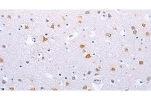 Immunohistochemistry of paraffin-embedded Human brain using HMGB3 Polyclonal Antibody at dilution of 1:30 (HMGB3 antibody)