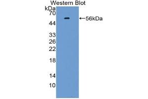 Western blot analysis of the recombinant protein. (KLF10/TIEG1 antibody  (AA 1-210))