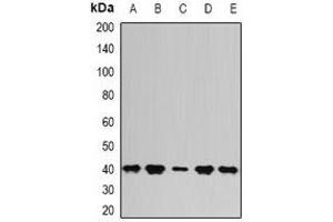 Western blot analysis of PSAT1 expression in Hela (A), SKOV3 (B), mouse kidney (C), mouse thymus (D), rat brain (E) whole cell lysates. (PSAT1 antibody)