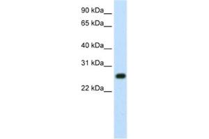 Western Blotting (WB) image for anti-MYC Induced Nuclear Antigen (MINA) antibody (ABIN2461954) (MINA antibody)