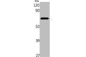 Western Blot analysis of rat kidney cells using Aladin Polyclonal Antibody (Adracalin antibody  (C-Term))