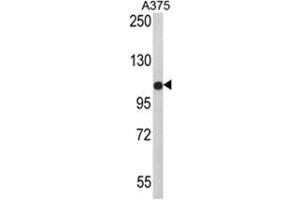 Western blot analysis of PALA Antibody (N-term) in A375 cell line lysates (35ug/lane). (TECPR1 / PALA (N-Term) antibody)