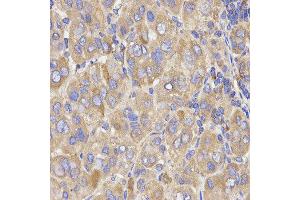 Immunohistochemistry (IHC) image for anti-Kinesin Light Chain 1 (KLC1) antibody (ABIN1876732) (KLC1 antibody)