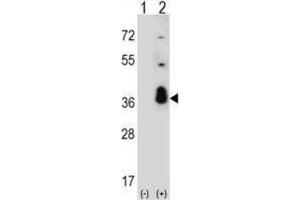 Western Blotting (WB) image for anti-serine/arginine-Rich Splicing Factor 1 (SRSF1) antibody (ABIN3002838) (SRSF1 antibody)