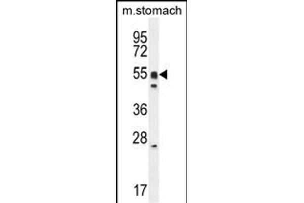 DMRTA1 antibody  (C-Term)