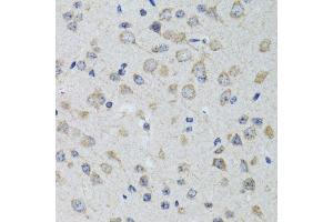 Immunohistochemistry of paraffin-embedded rat brain using HTR3A antibody. (Serotonin Receptor 3A antibody  (AA 24-241))
