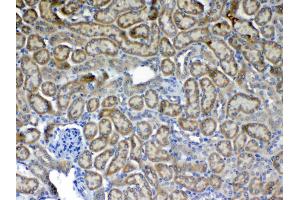 Immunohistochemistry (IHC) image for anti-Fms-Related tyrosine Kinase 3 (FLT3) (AA 62-295) antibody (ABIN5518988)