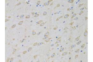 Immunohistochemistry of paraffin-embedded mouse brain using GARS antibody (ABIN5973156) at dilution of 1/100 (40x lens). (GARS antibody)