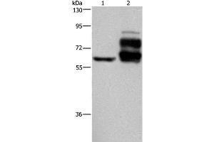 Western Blot analysis of Jurkat cell and Human rectal cancer tissue using PCSK9 Polyclonal Antibody at dilution of 1:200 (PCSK9 antibody)