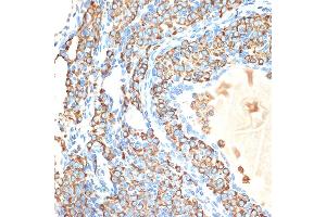 Immunohistochemistry of paraffin-embedded rat ovary using CYPOR Rabbit mAb (ABIN7269151) at dilution of 1:100 (40x lens). (POR antibody)