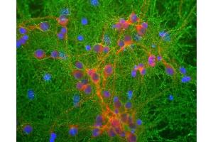 Mixed neuronal cultures stained with ABIN1580421 (green), RPCA-MAP2, a rabbit antibody to microtubule associated protein 2 (MAP2, red) and DNA (blue).