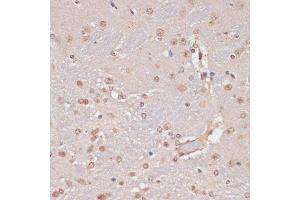 Immunohistochemistry of paraffin-embedded mouse brain using PIDD antibody (ABIN1680710, ABIN3019230, ABIN3019231, ABIN5664897 and ABIN6220775) at dilution of 1:100 (40x lens).