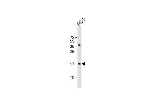 NDUFAF3 antibody  (N-Term)