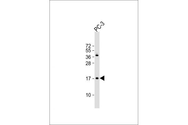NDUFAF3 antibody  (N-Term)