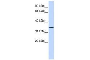 RHCE antibody  (N-Term)