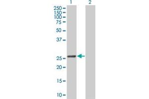 Western Blot analysis of GSTK1 expression in transfected 293T cell line by GSTK1 MaxPab polyclonal antibody. (GSTK1 antibody  (AA 1-226))