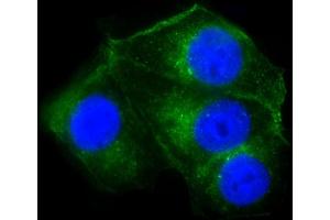 Immunofluorescent analysis of 4 % paraformaldehyde-fixed, 0. (Cathepsin D antibody  (AA 1-412))