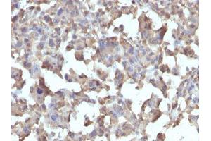 Image no. 1 for anti-Tumor Necrosis Factor alpha (TNF alpha) antibody (ABIN6171941) (TNF alpha antibody)
