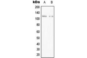 Western blot analysis of PPFIBP1 expression in Jurkat (A), HEK293T (B) whole cell lysates.