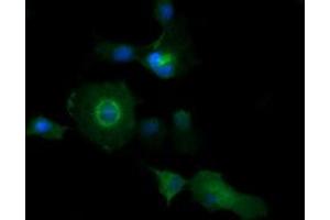 Image no. 1 for anti-Phosphatidylinositol-4-Phosphate 3-Kinase, Catalytic Subunit Type 2 beta (PIK3C2B) antibody (ABIN1500198) (PIK3C2B antibody)