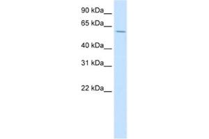 Western Blotting (WB) image for anti-Homeobox D3 (HOXD3) antibody (ABIN2461608) (HOXD3 antibody)