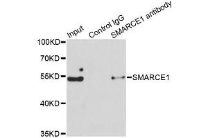 Immunoprecipitation analysis of 150ug extracts of Jurkat cells using 3ug SMARCE1 antibody (ABIN6290090). (SMARCE1 antibody)