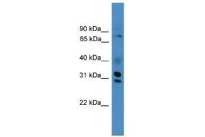 GIPC3 antibody used at 0. (GIPC3 antibody  (Middle Region))