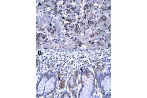 Immunohistochemical staining (Formalin-fixed paraffin-embedded sections) of human liver (A) and human stomach (B) with RBPJ polyclonal antibody  at 4-8 ug/mL working concentration. (RBPJ antibody  (C-Term))