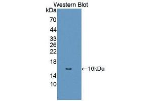 Western blot analysis of recombinant Human DRD1.