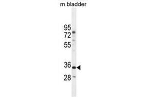 C17orf59 Antibody (Center) western blot analysis in mouse bladder tissue lysates (35µg/lane). (C17orf59 antibody  (Middle Region))