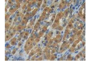 Detection of AST in Rat Intestine Tissue using Polyclonal Antibody to Aspartate Aminotransferase (AST)