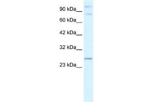 WB Suggested Anti-PCGF3 Antibody Titration:  2. (PCGF3 antibody  (Middle Region))