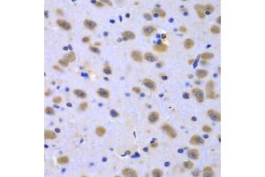 Immunohistochemistry of paraffin-embedded rat brain using CIAO1 antibody (ABIN5975509) at dilution of 1/100 (40x lens). (CIAO1 antibody)
