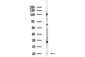 anti-SNAP-Associated Protein (SNAPIN) (N-Term) antibody