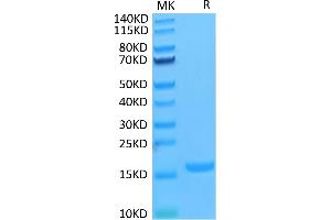 Human IL-18 on Tris-Bis PAGE under reduced condition. (IL-18 Protein)