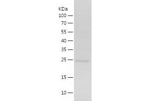 Western Blotting (WB) image for Inhibitor of Growth Family, Member 4 (ING4) (AA 1-199) protein (His tag) (ABIN7282993) (ING4 Protein (AA 1-199) (His tag))