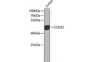 Western blot analysis of extracts of Jurkat cells using CCNE2 Polyclonal Antibody. (Cyclin E2 antibody)