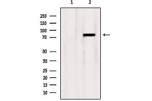 Western blot analysis of extracts from Mouse lung, using OSBP Antibody. (OSBP antibody  (Internal Region))
