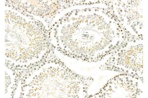 ABIN6259574 and ABIN6275790 at 1/100 staining Rat testis tissue by IHC-P.
