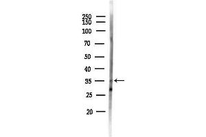 anti-Forkhead Box B1/2 (FOXB1/2) antibody
