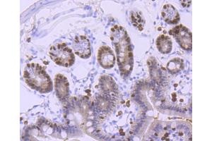 Paraformaldehyde-fixed, paraffin embedded mouse colon, Antigen retrieval by boiling in sodium citrate buffer (pH6) for 15min, Block endogenous peroxidase by 3% hydrogen peroxide for 30 minutes, Blocking buffer at 37°C for 20min, Antibody incubation with FOXA1 (5F7) Monoclonal Antibody  at 1:50 overnight at 4°C, followed by a conjugated secondary and DAB staining. (FOXA1 antibody)