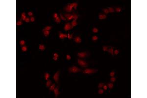 ABIN6277780 staining HeLa by IF/ICC. (PKC epsilon antibody  (pSer729))